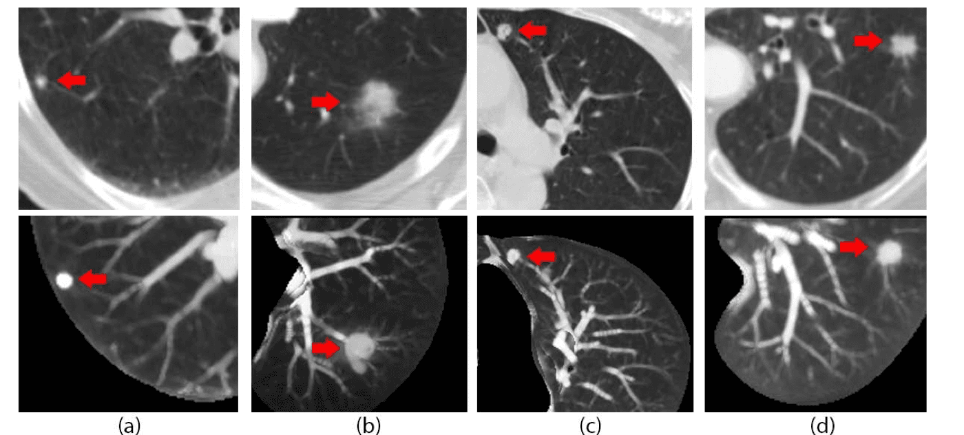 High-resolution chest CT slice